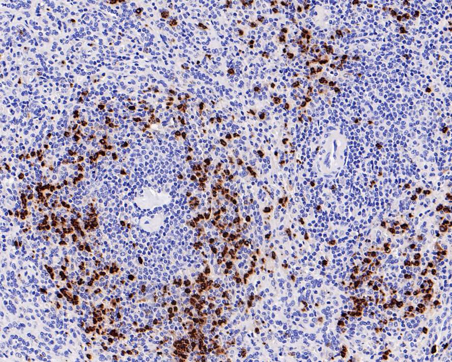 Myeloperoxidase/MPO Antibody (PD00-20)