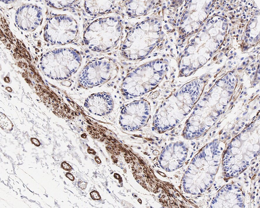 MYL9 Antibody (JE34-63)