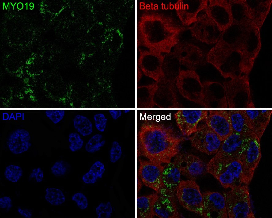 MYO19 Antibody (JE64-30)