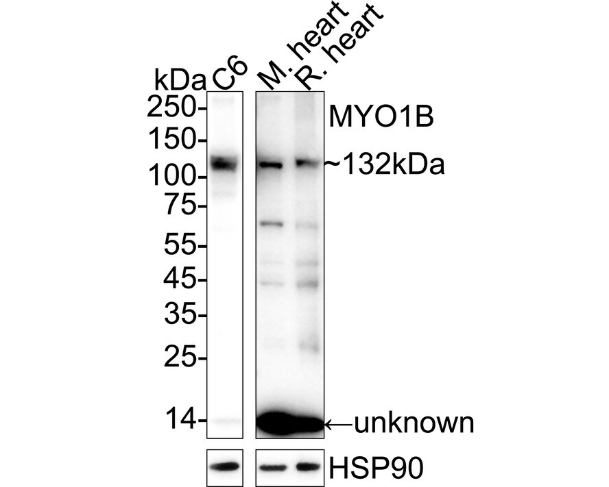 Myosin 1B Antibody (JE65-01) Western Blot: Myosin 1B Antibody (JE65-01) [NBP3-32629]
