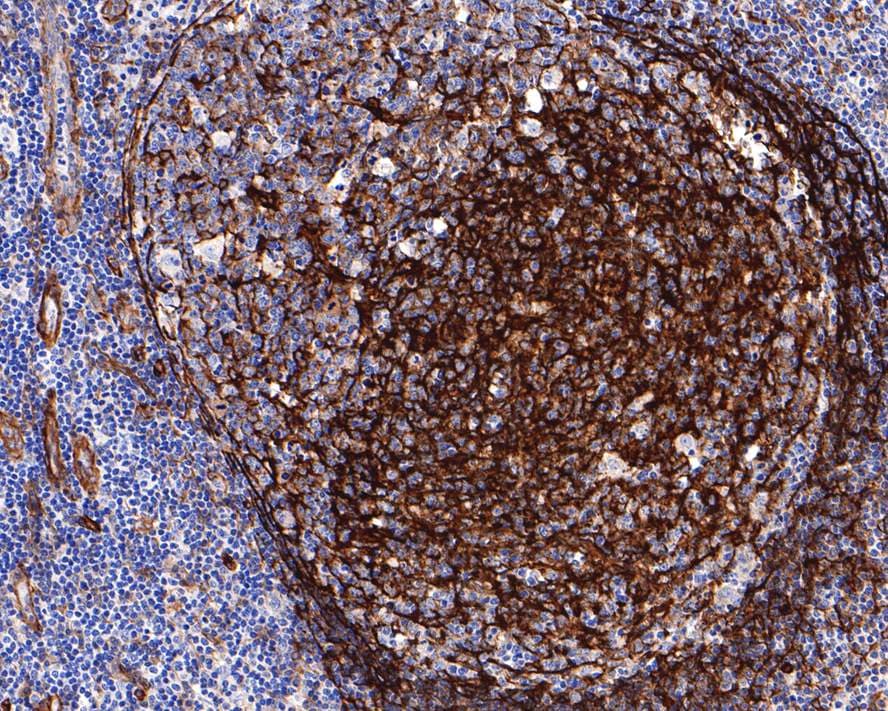 Myosin 1B Antibody (JE65-01)