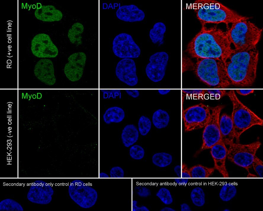 MyoD Antibody (JE60-47)