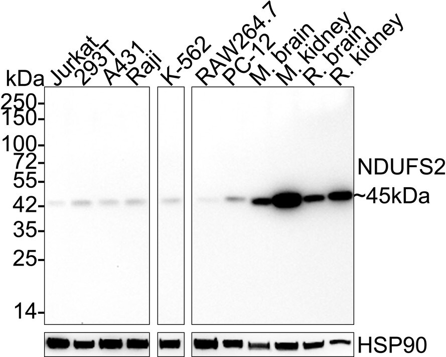 NDUFS2 Antibody (JE65-29) Western Blot: NDUFS2 Antibody (JE65-29) [NBP3-32638]