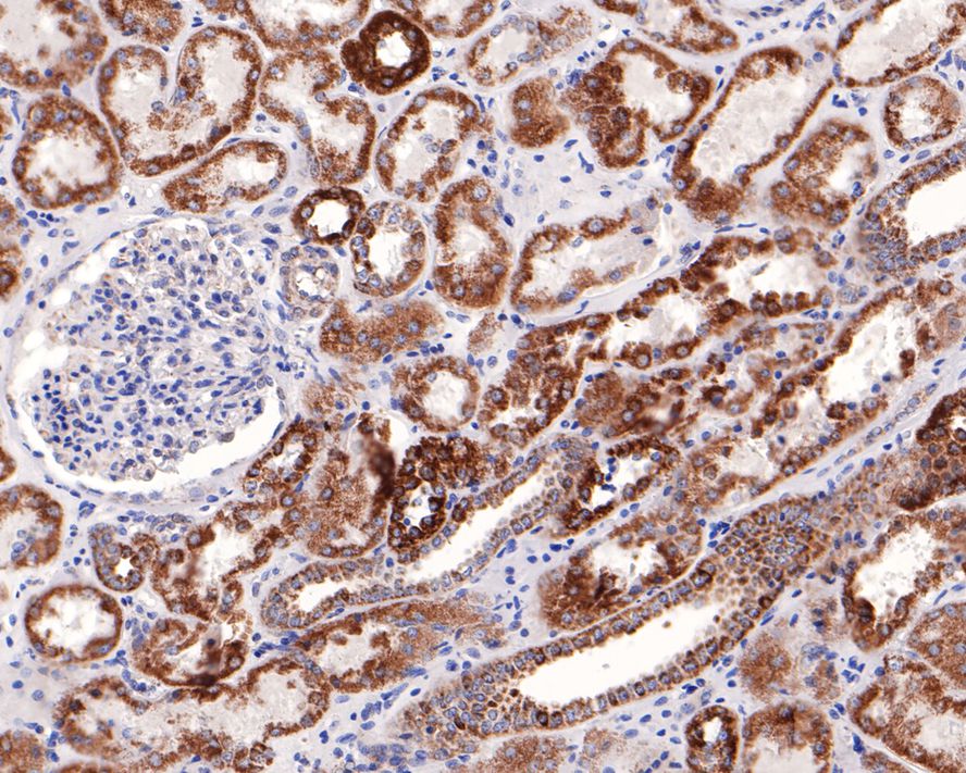 NDUFS2 Antibody (JE65-29)