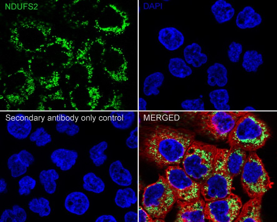 NDUFS2 Antibody (PSH03-26)