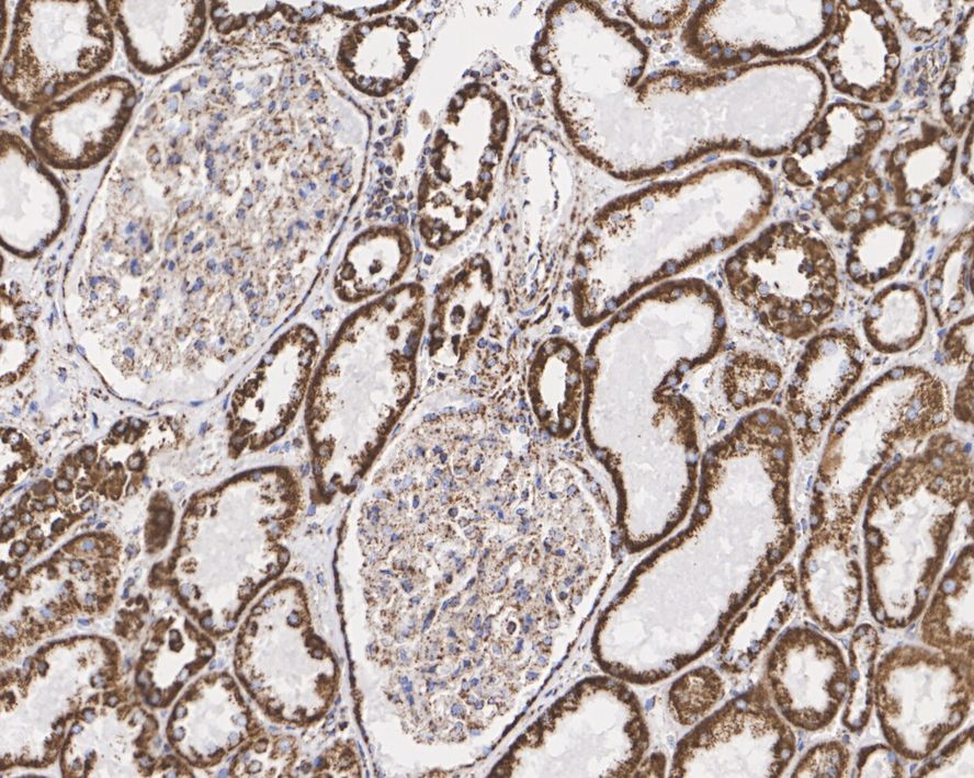 NDUFS2 Antibody (PSH03-26)