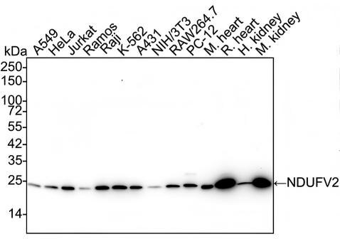 NDUFV2 Antibody (PSH02-86) Western Blot: NDUFV2 Antibody (PSH02-86) [NBP3-32640]