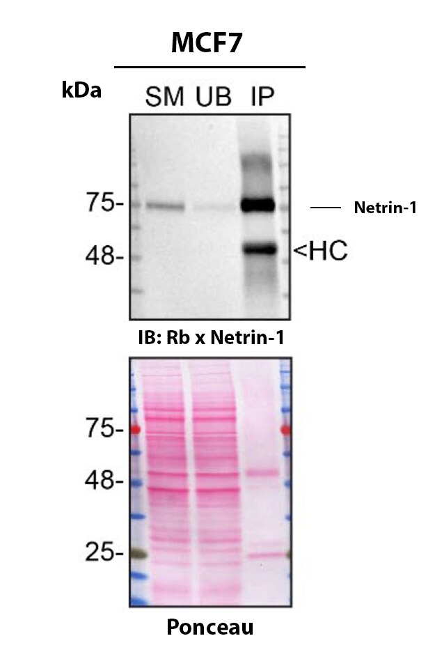 Netrin-1 Antibody (JE38-87) Detection of Netrin-1 by Immunoprecipitation.