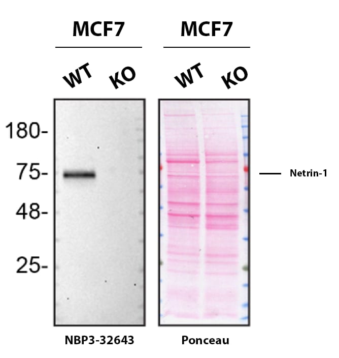 Netrin-1 Antibody (JE38-87) Western Blot Shows Netrin-1 Specificity Using Knockout Cell Line.