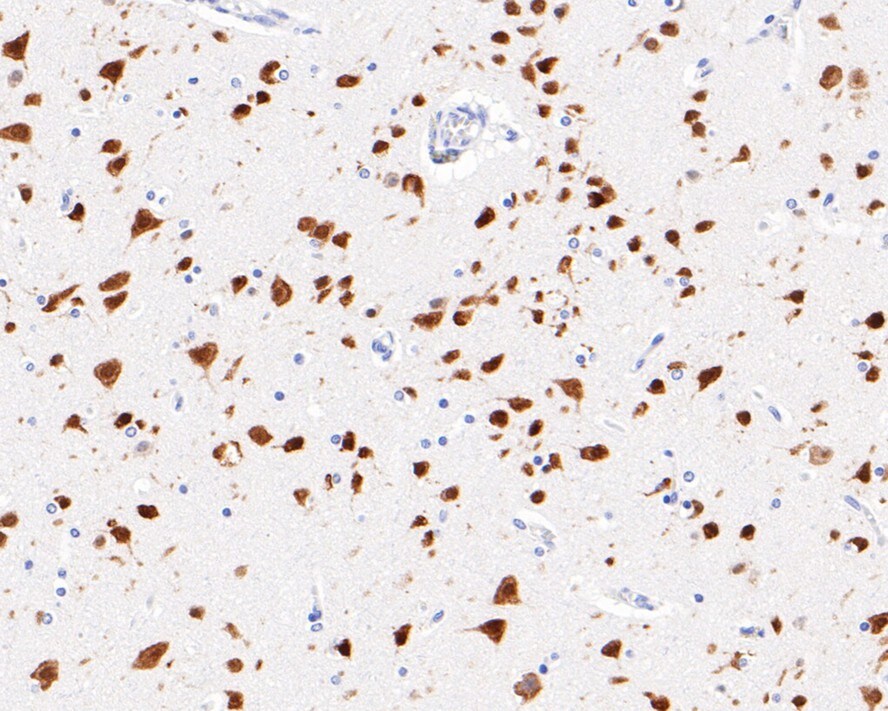 RBFOX3/NeuN Antibody (PD01-45)