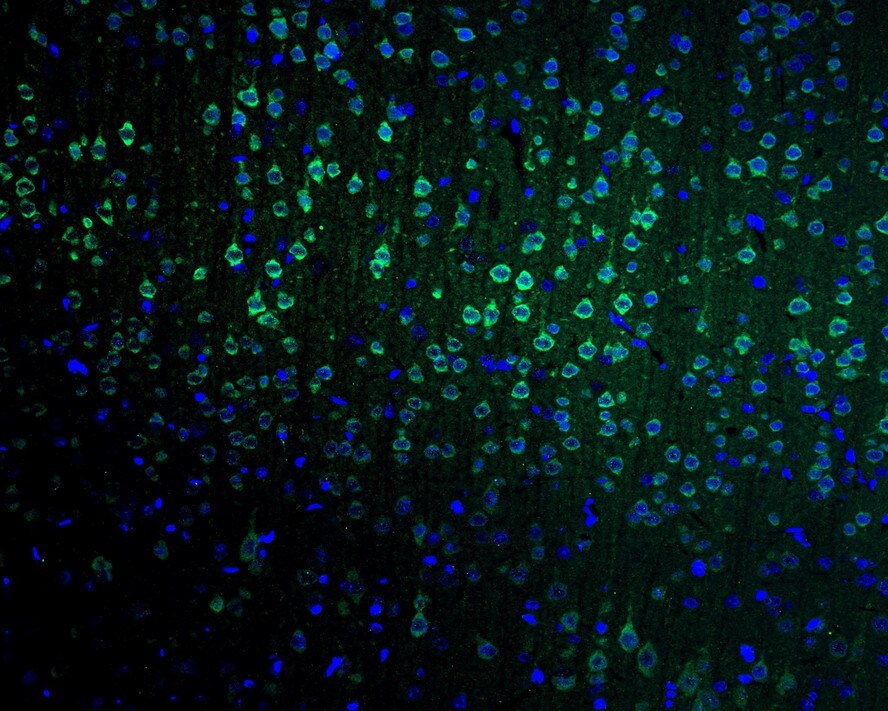 Neurogranin Antibody (PSH02-96)
