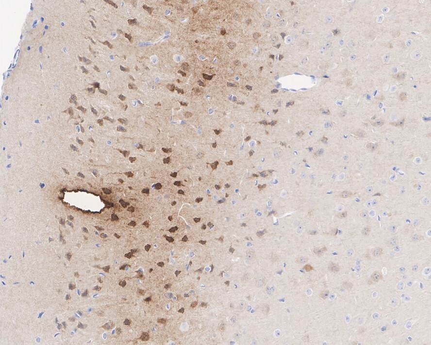 Neurogranin Antibody (PSH02-96)