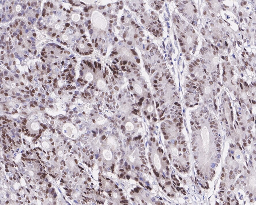 Nuclear Factor Erythroid Derived 2 Antibody (JE65-92)