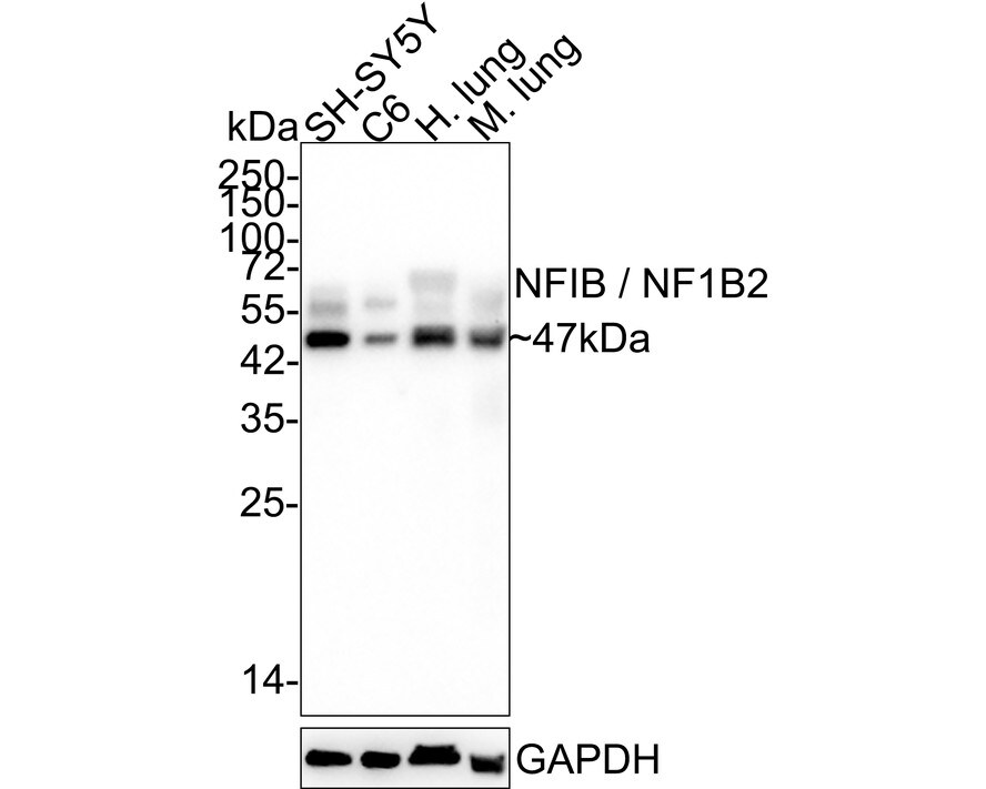 NFIB Antibody (JE35-21) Western Blot: NFIB Antibody (JE35-21) [NBP3-32647]