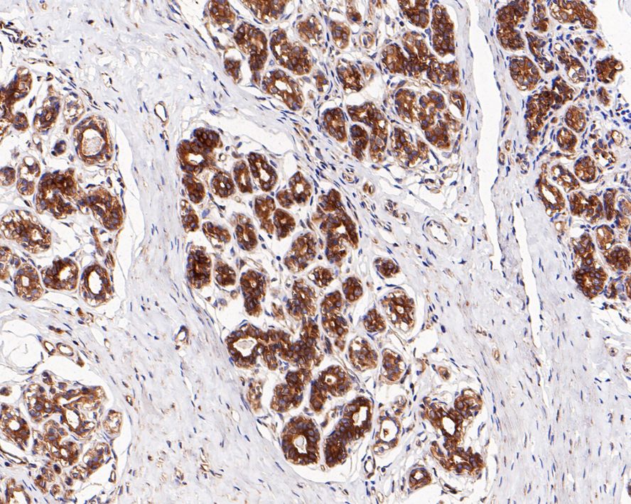RelA/NFkB p65 Antibody (PSH0-27)
