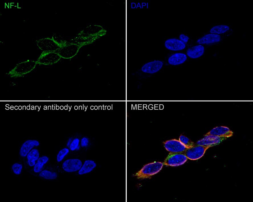 NF-L Antibody (PSH0-77)