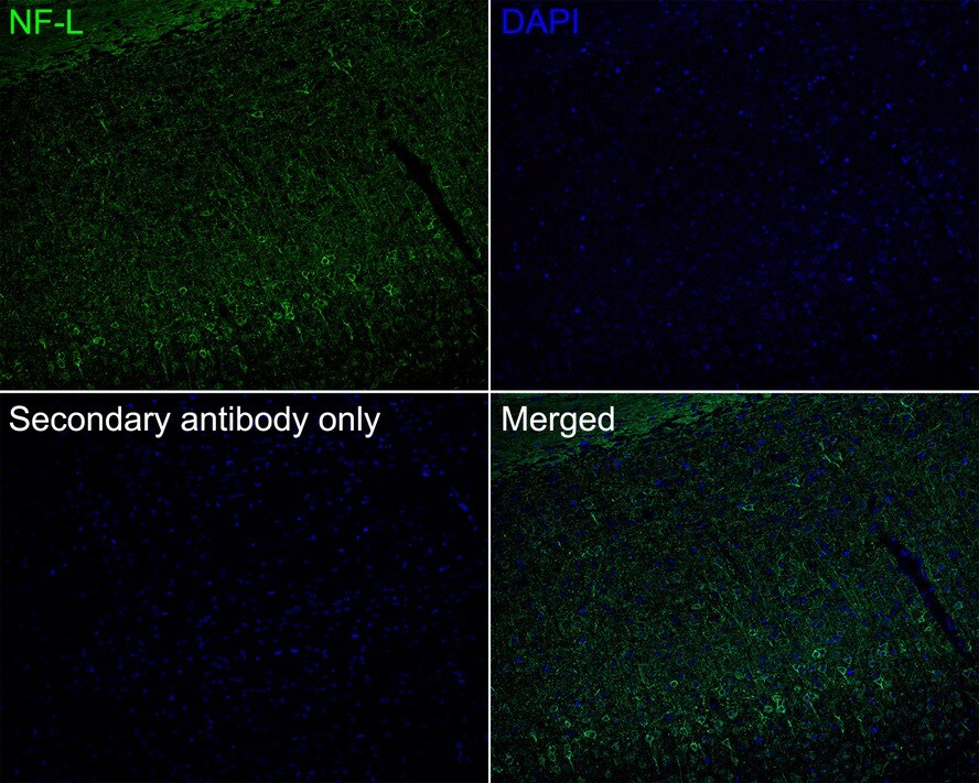 NF-L Antibody (PSH0-77)