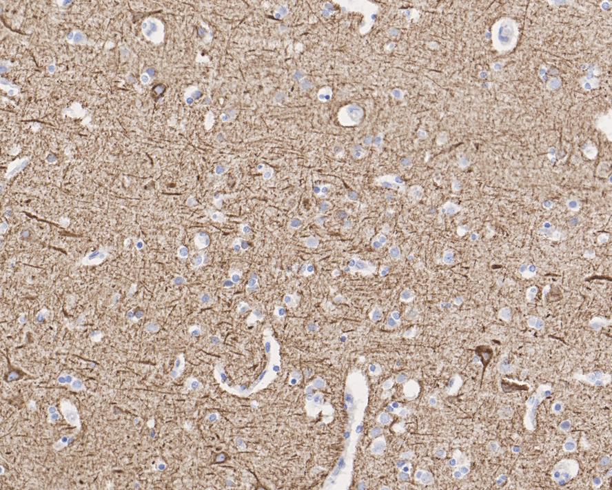 NF-L Antibody (PSH0-77)