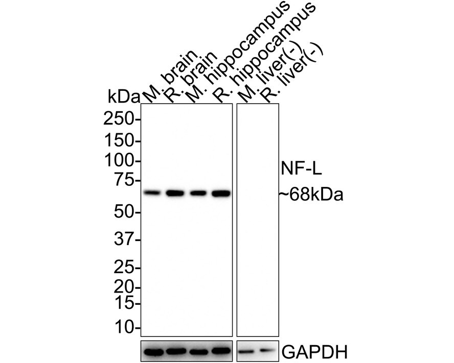 NF-L Antibody (PS02-10) Western Blot: NF-L Antibody (PS02-10) [NBP3-32650]