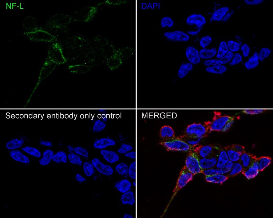 NF-L Antibody (PS02-10)
