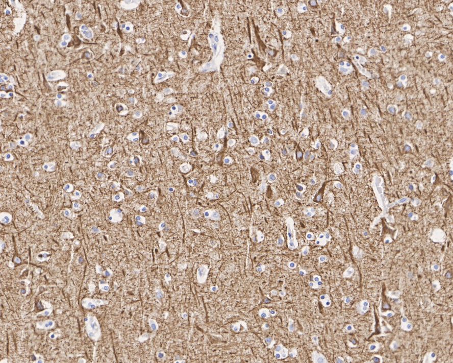 NF-L Antibody (PS02-10)
