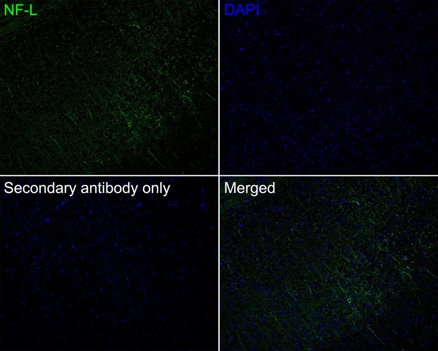 NF-L Antibody (PS02-10)