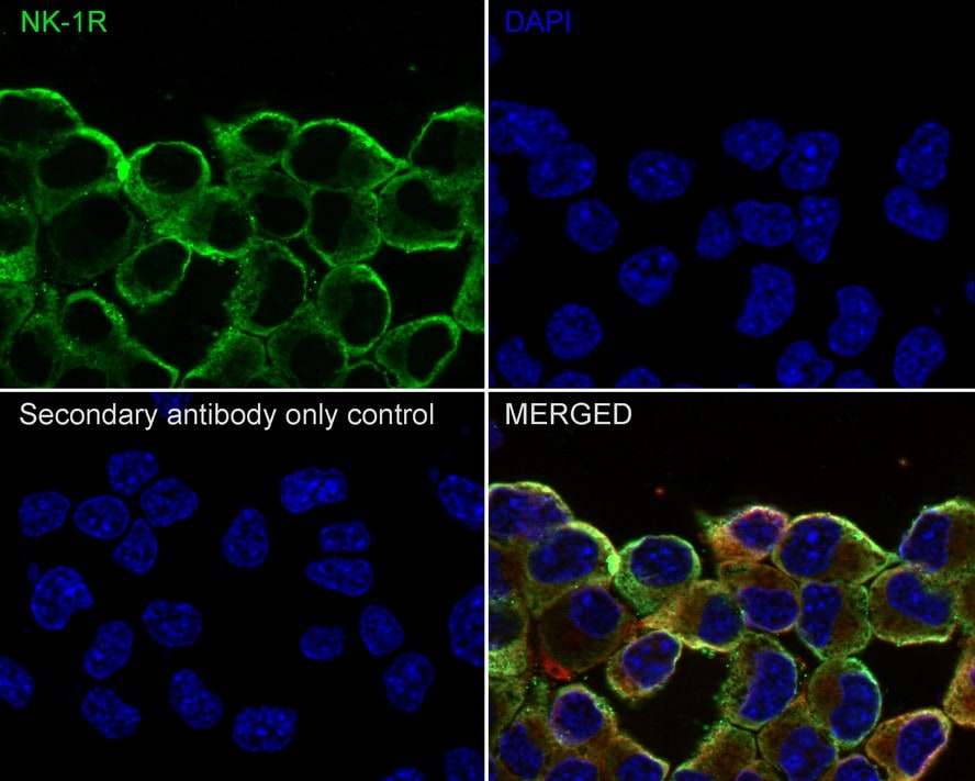 NK1R Antibody (JE39-75)