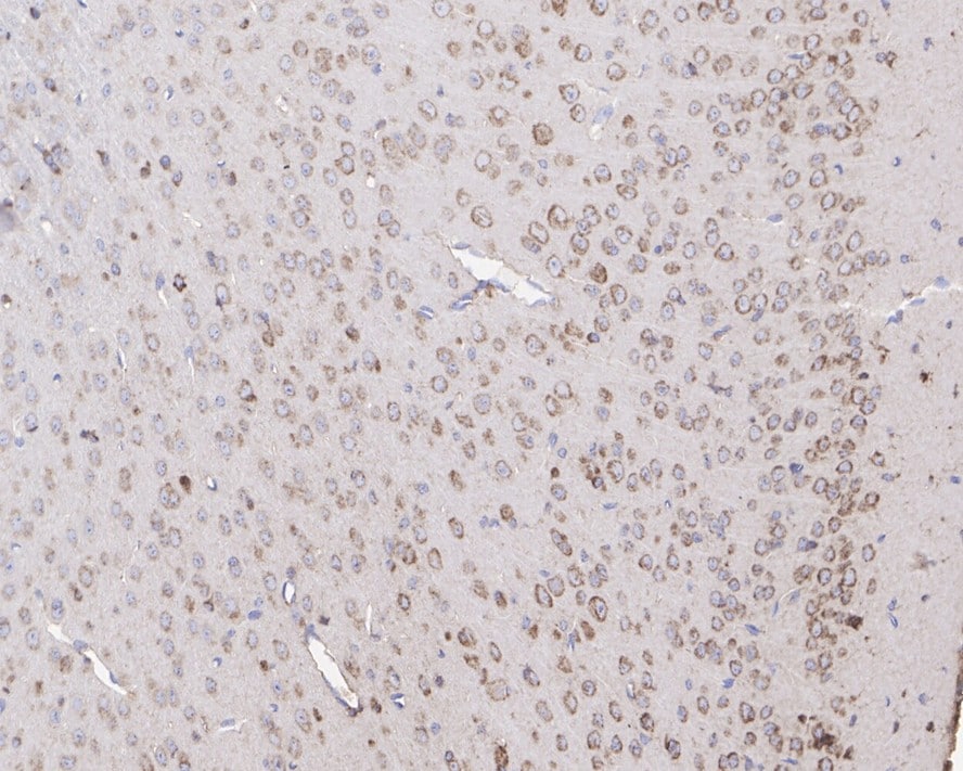 NK1R Antibody (JE39-75)