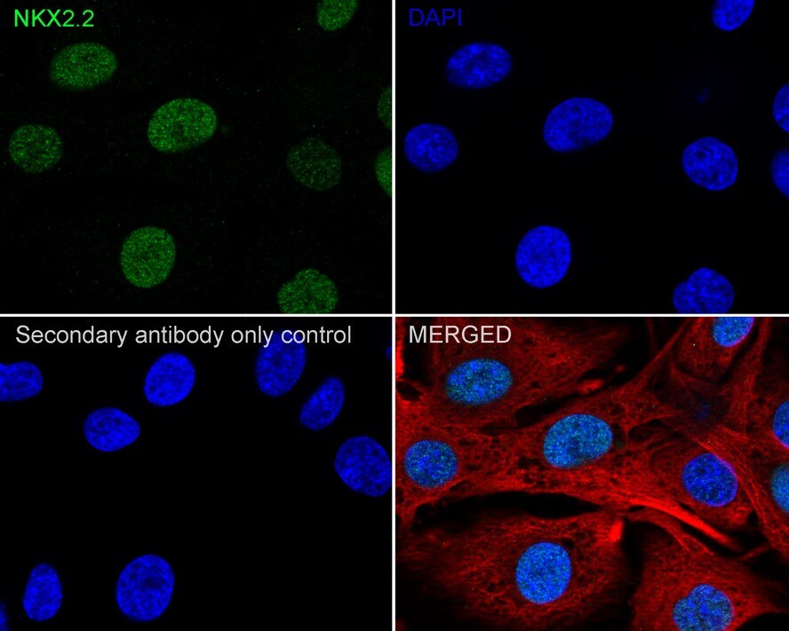 NKX2.2 Antibody (JE60-66)
