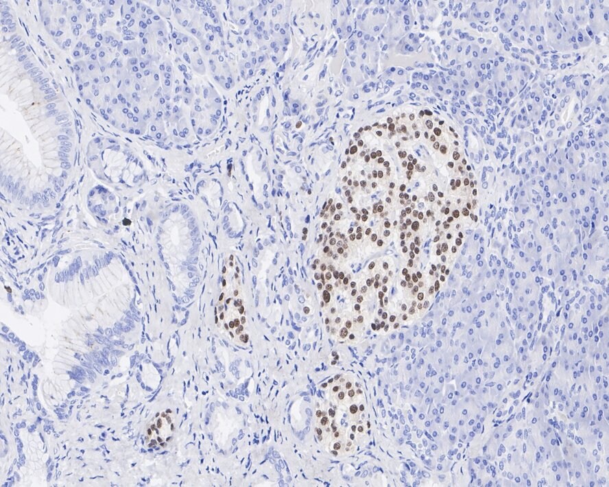 NKX2.2 Antibody (JE60-66)