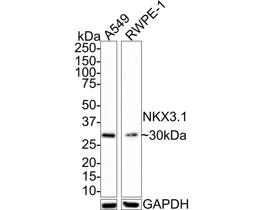 NKX3.1 Antibody (JE36-27)