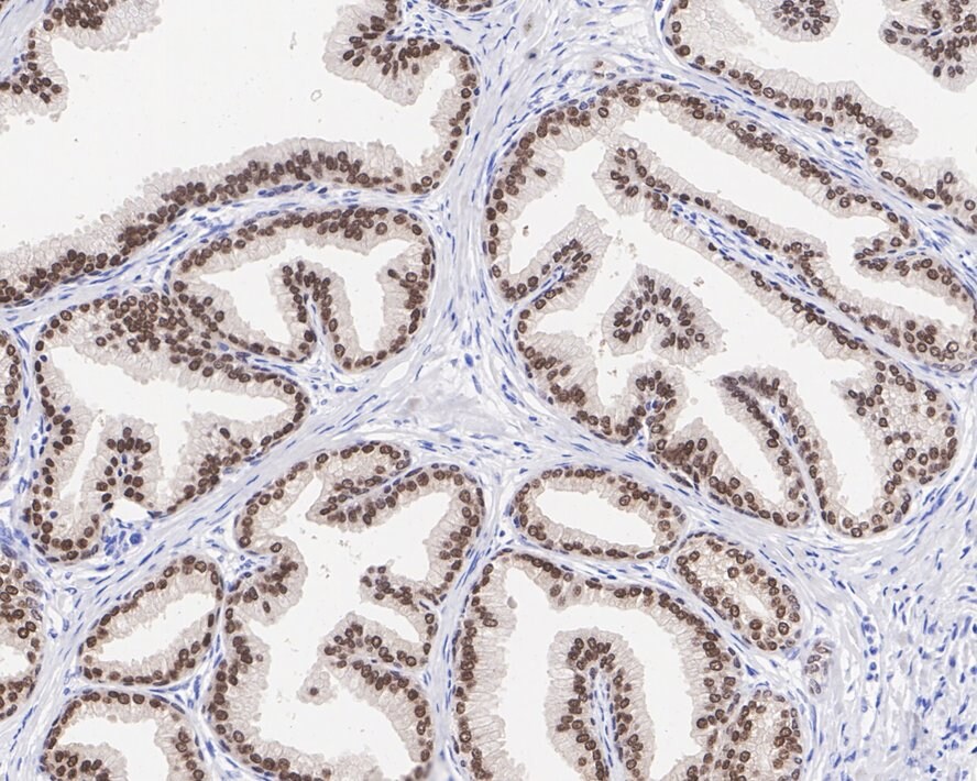 NKX3.1 Antibody (JE36-27)