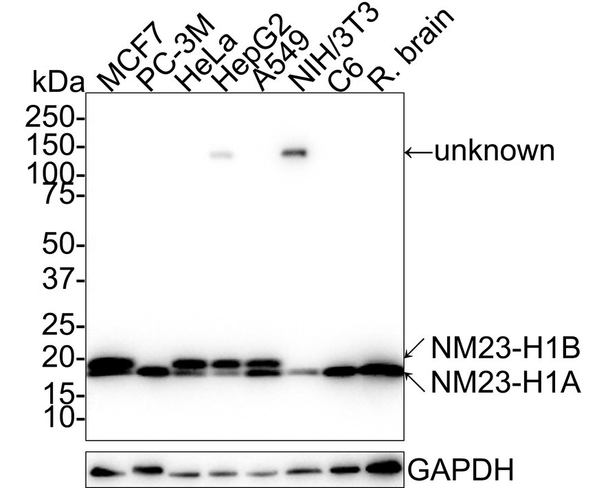 NM23-H1 Antibody (12A1-R) Western Blot: NM23-H1 Antibody (12A1-R) [NBP3-32656]