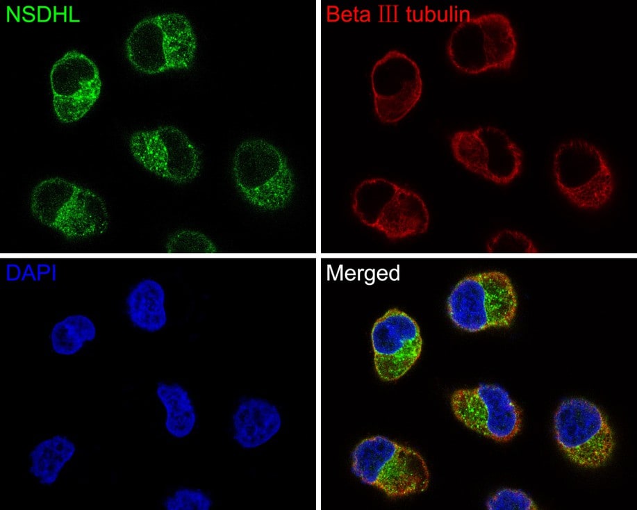 NSDHL Antibody (JE64-86)