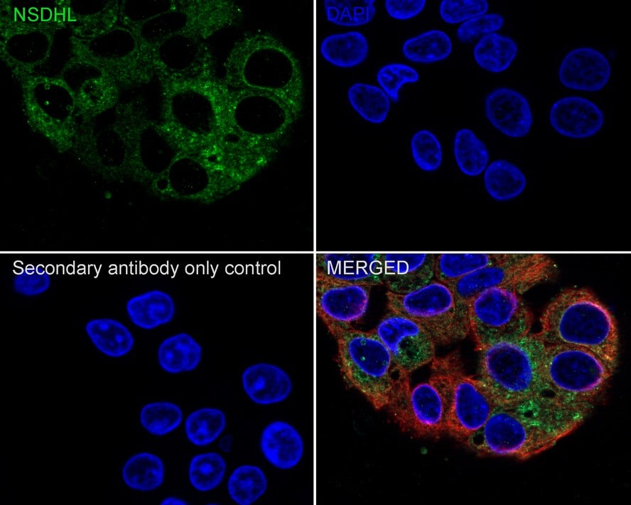 NSDHL Antibody (PSH02-36)