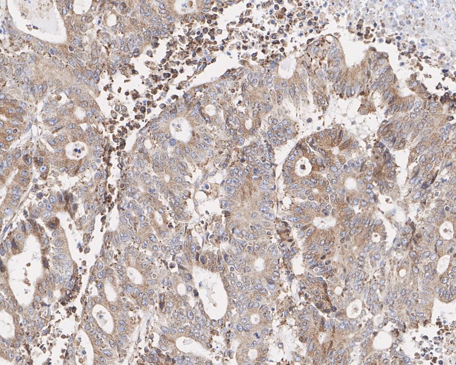 NSDHL Antibody (PSH02-36)