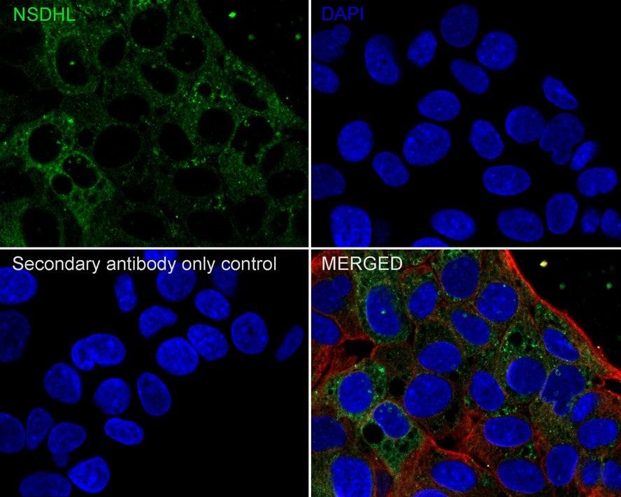 NSDHL Antibody (PSH02-37)