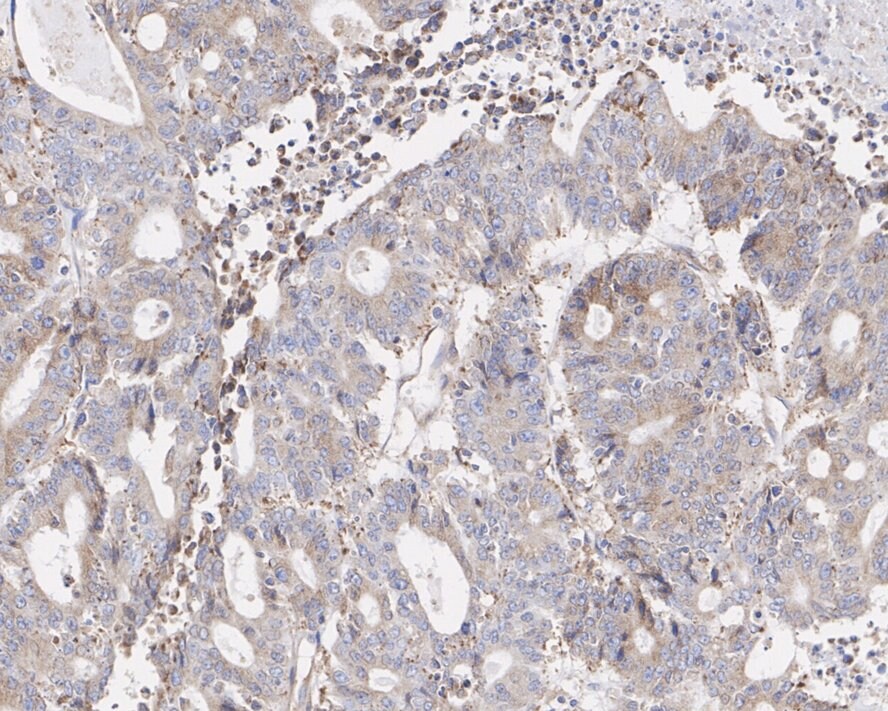 NSDHL Antibody (PSH02-37)