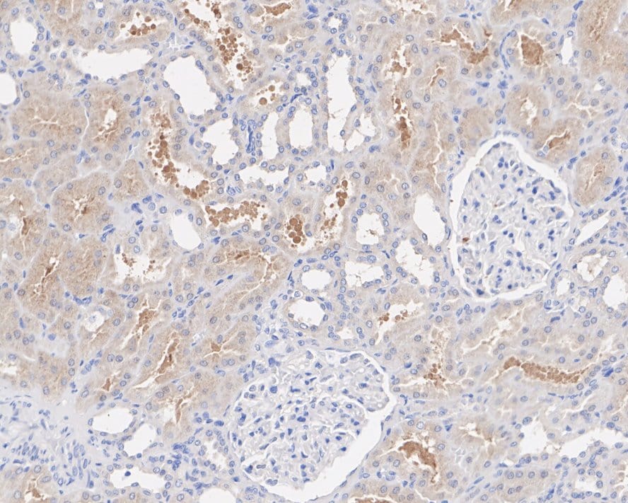 NSUN3 Antibody (PSH01-97)