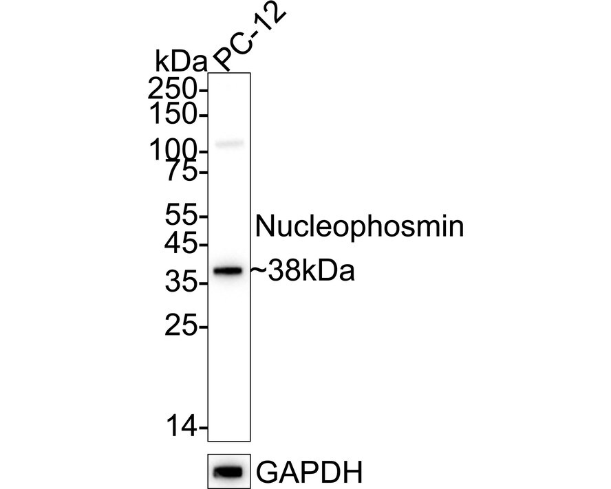 NPM1 Antibody (PD00-91) Western Blot: NPM1 Antibody (PD00-91) [NBP3-32669]