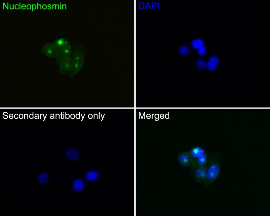 NPM1 Antibody (PD00-91)