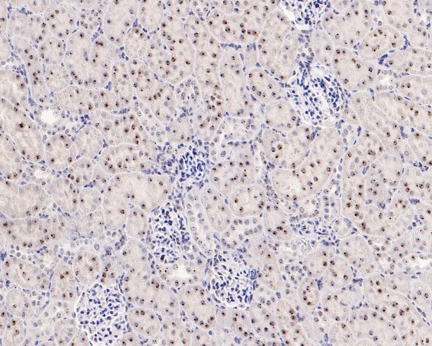 NPM1 Antibody (PD00-91)