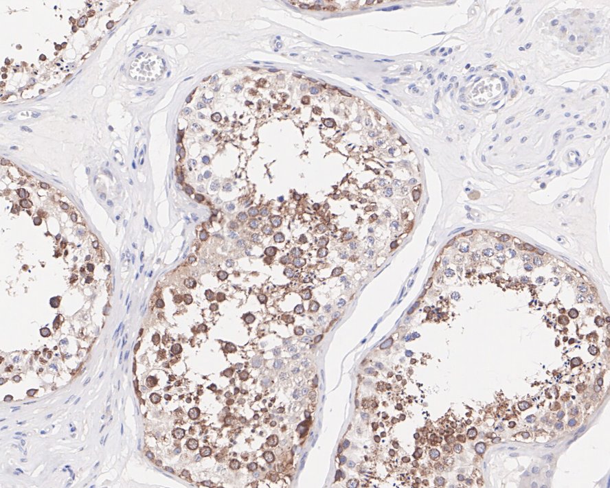 NUP62 Antibody (JE55-09)