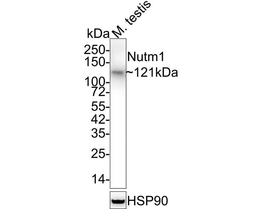 NUT Antibody Western Blot: NUT Antibody [NBP3-32672]
