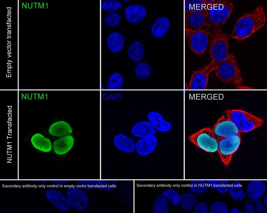 NUT Antibody