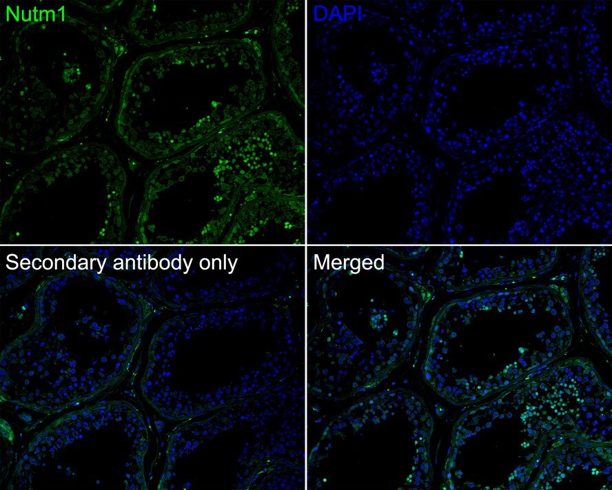 NUT Antibody