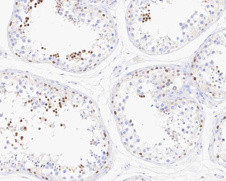 NUT Antibody