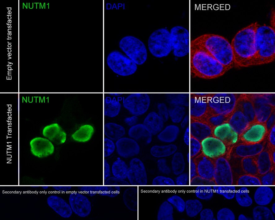 NUT Antibody (PSH02-78)