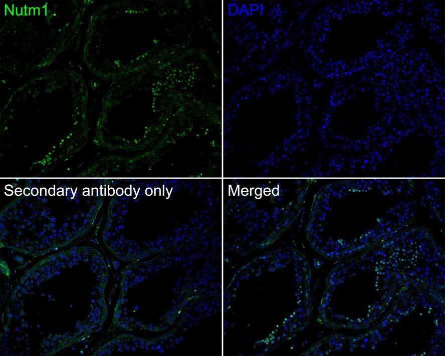 NUT Antibody (PSH02-78)