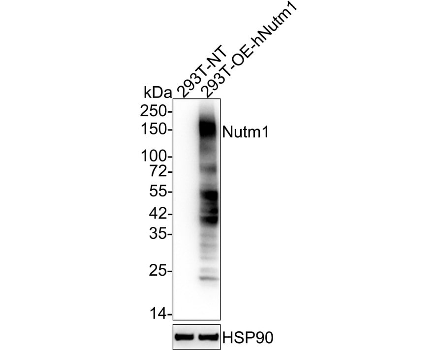 NUT Antibody (PSH03-36) Western Blot: NUT Antibody (PSH03-36) [NBP3-32674]